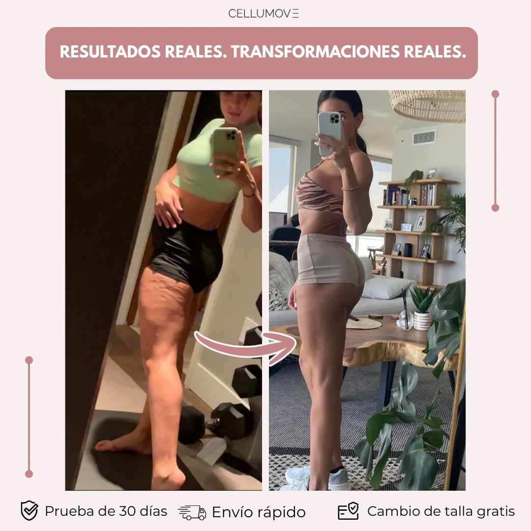 Calzas anticelulíticas para mujeres que lo han probado todo: resultados visibles en 14 días